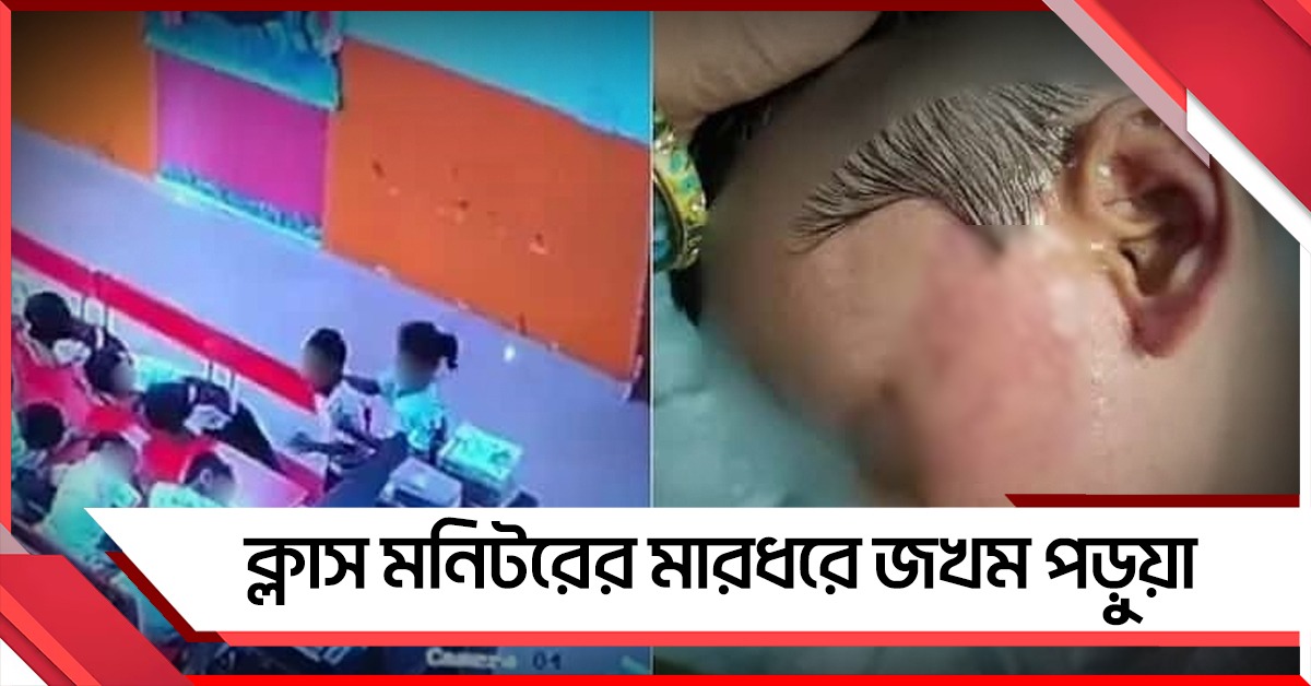 শিক্ষিকা বেরোতেই তাণ্ডব, ক্লাস মনিটরের মারধরে জখম পড়ুয়া