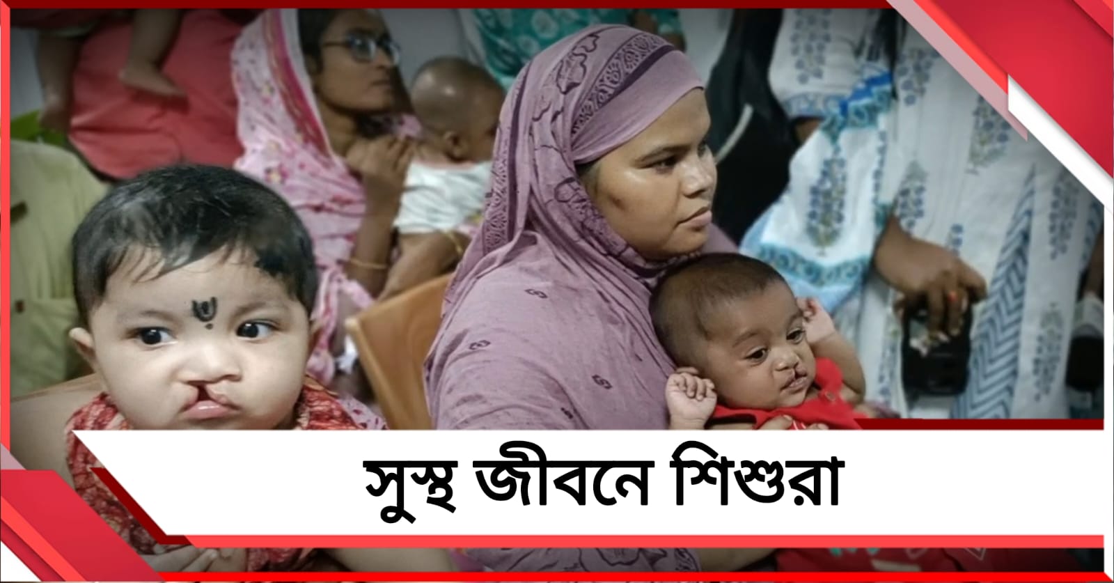 চার বছরে ১১০০ শিশুর মুখে হাসি! কৃষ্ণনগরে ফের বিনামূল্যে ঠোঁটকাটা অস্ত্রোপচার শিবির