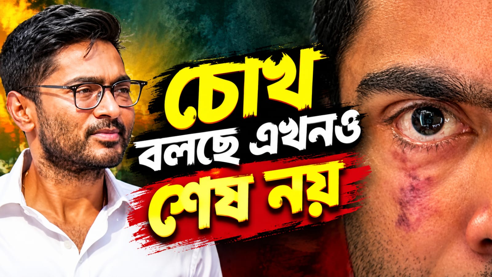 'চোখ বলছে এখনও শেষ নয়', চিকিৎসাধীন অভিষেকের ইনস্টা স্টোরি ঘিরে জোর চর্চা