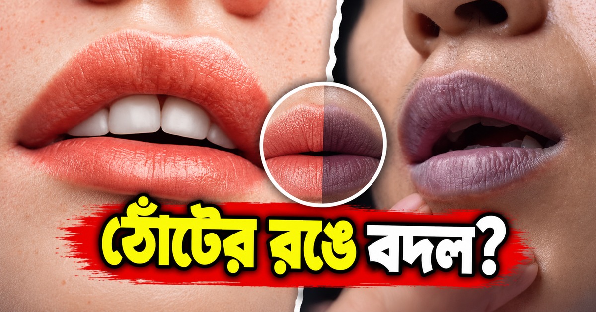 ঠোঁটের রঙে বদল? বড় বিপদের লক্ষণ নয় তো!