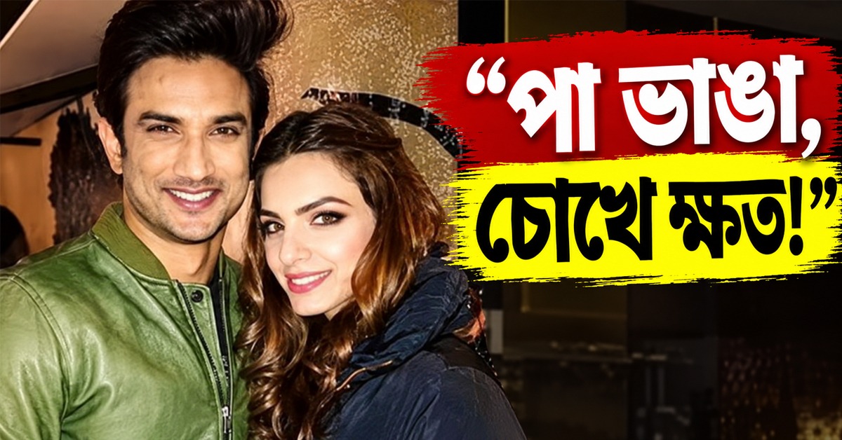 “পা ভাঙা, চোখে ক্ষত!” সুশান্তের ময়নাতদন্ত নিয়ে বিস্ফোরক অভিযোগ দিদি শ্বেতার