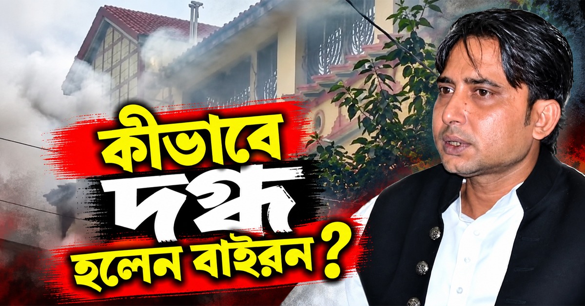 কীভাবে দগ্ধ হলেন বাইরন? জানালেন বিধায়কের ভাই